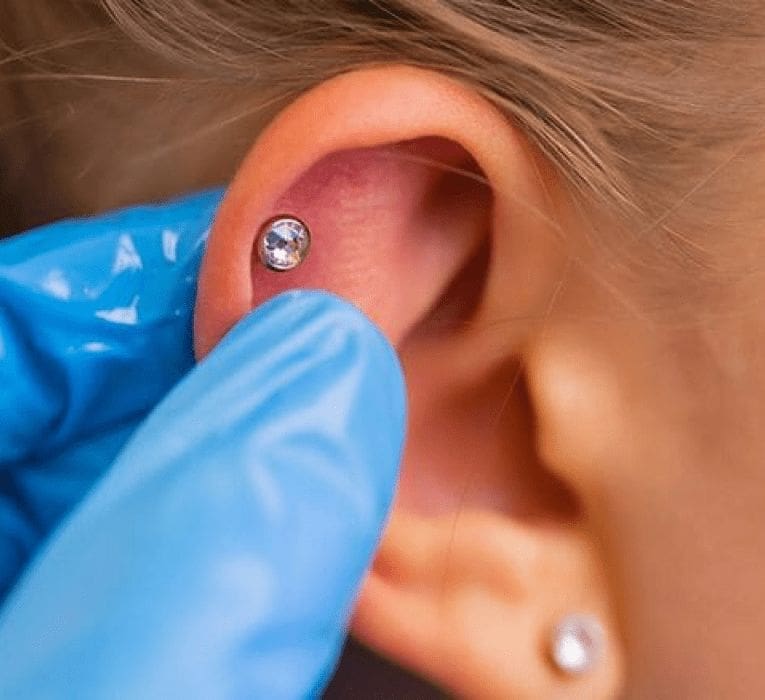 Comprehensive Guide to Dermal Piercings: All You Need to Know